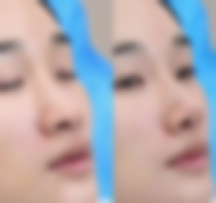 【杭州新城医院整形外科参考价格表:】