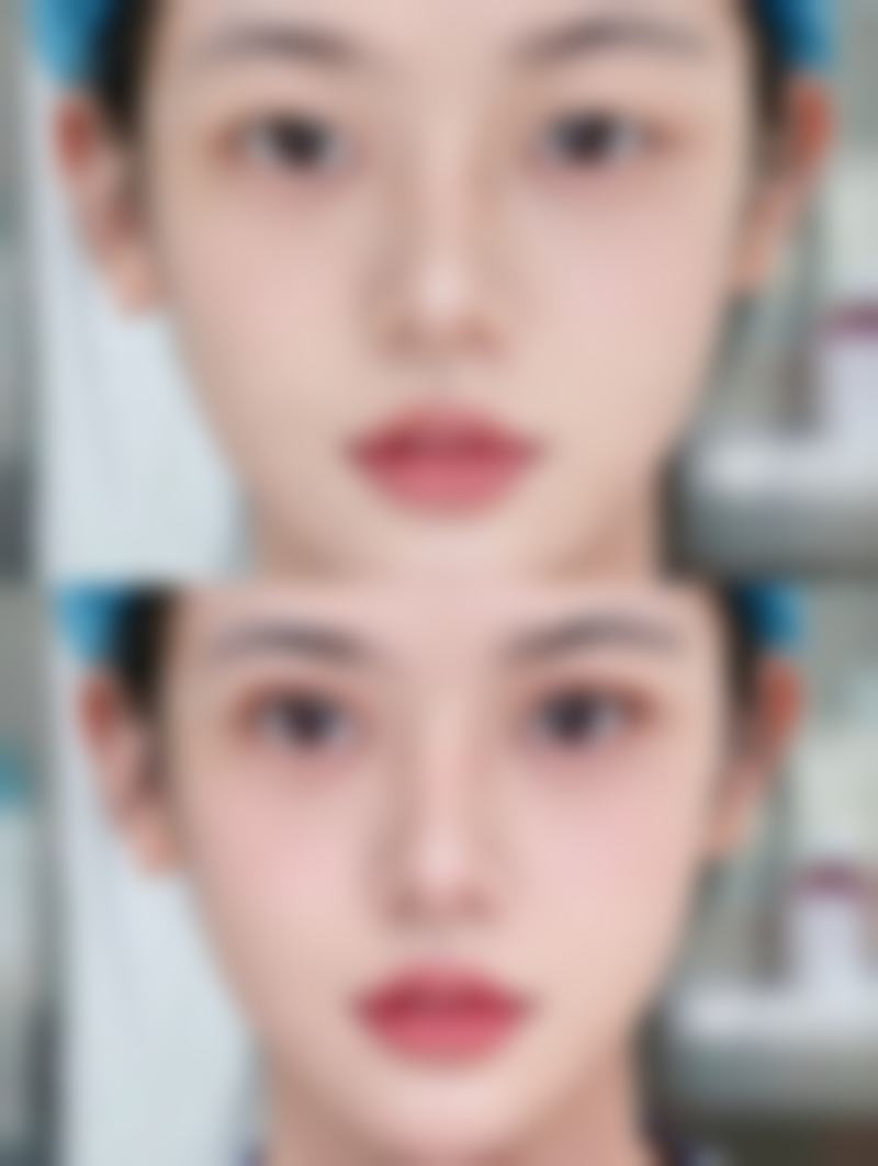 【吕曼群医生技术特点：】