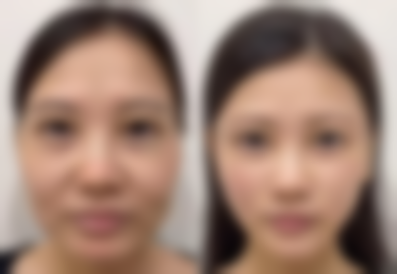 【玛莎国内外医学美容医院是正规的吗?】