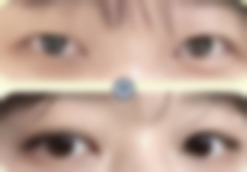 【合阳县柠檬树整形医院怎么预约挂号?】