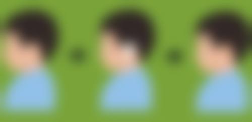 打完瘦脸针8天了感觉脸还是肿的