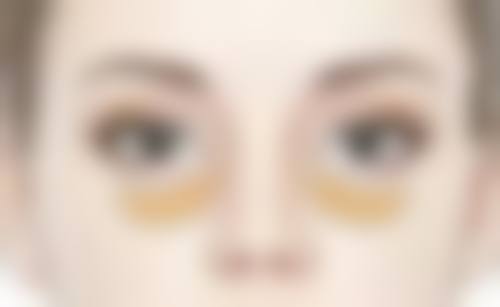 下巴整形前后对比照片