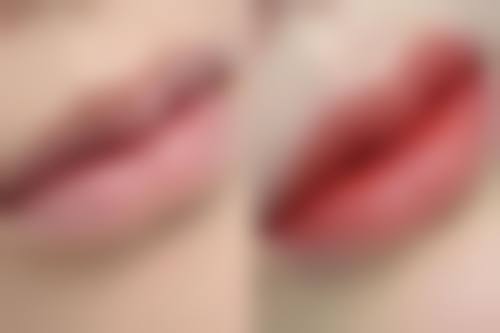 【武汉奇佶医疗美容门诊部特色项目：】