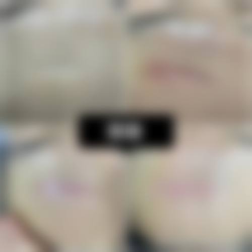 【烟台英杰医疗美容特色项目:】