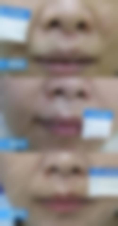 【南昌伊丽医疗美容整形医院患者口碑评价：】