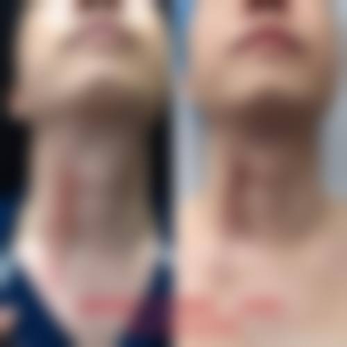 【桂林新华医疗美容门诊部怎么预约挂号?】