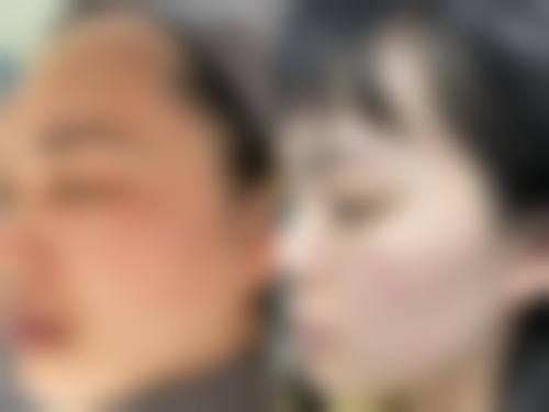 【金娟医生技术特点：】