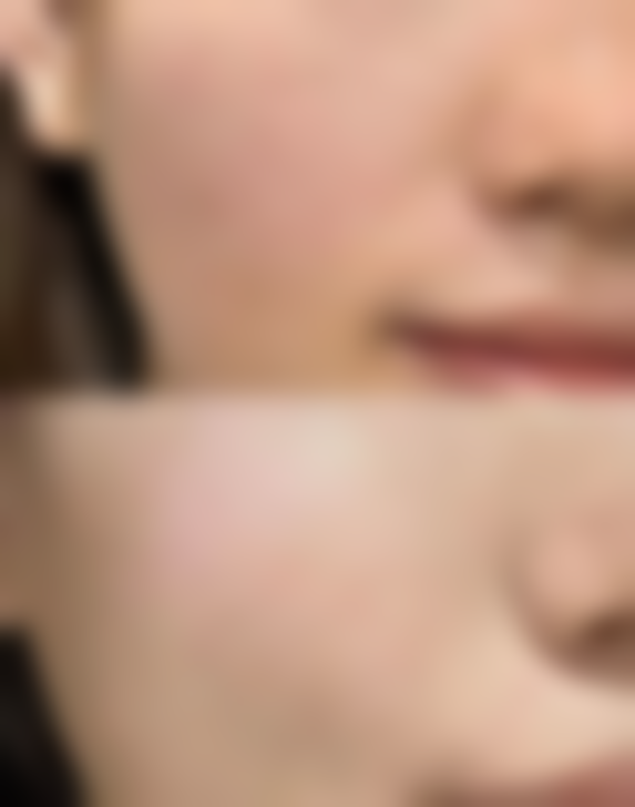 【南昌伊丽医疗美容整形医院怎么预约挂号?】