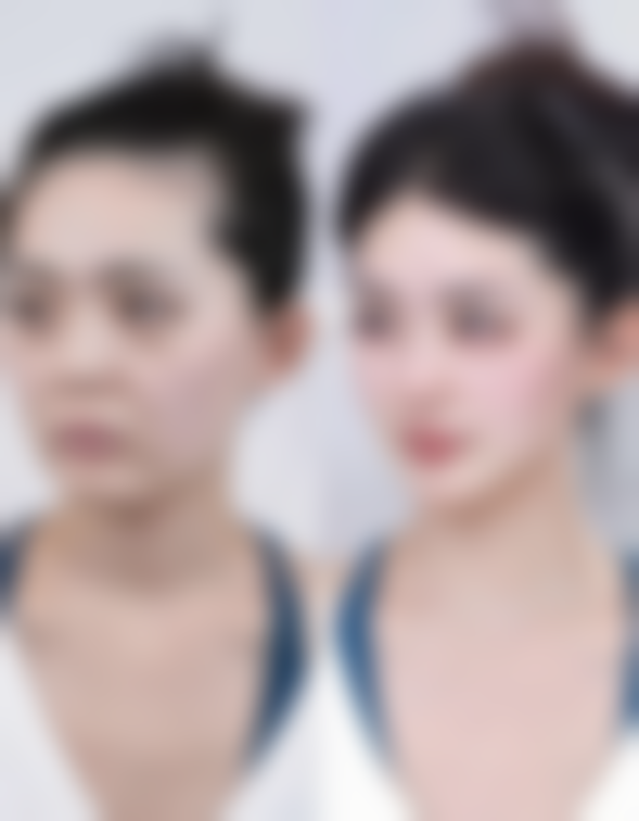 【辽阳文圣整形医疗美容医院特色项目:】