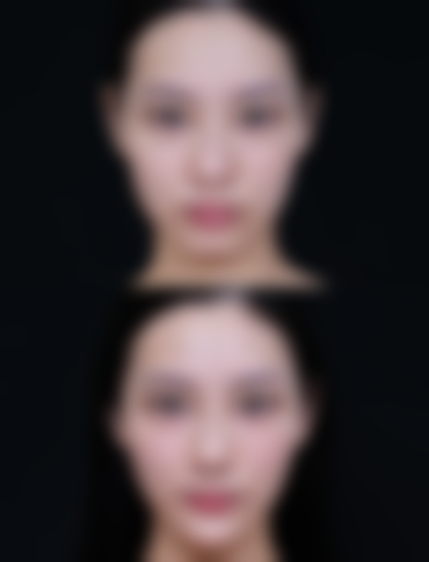 【烟台英杰医疗美容患者口碑评价:】