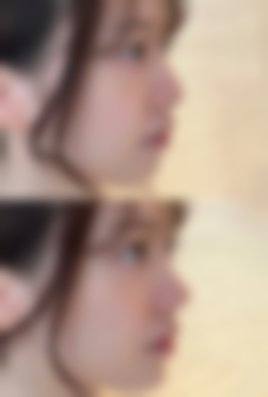 【狎鸥亭YK 整形外科是正规的吗?】