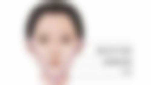 打瘦脸针会垮脸吗