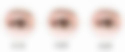 一针瘦脸针成效明显吗