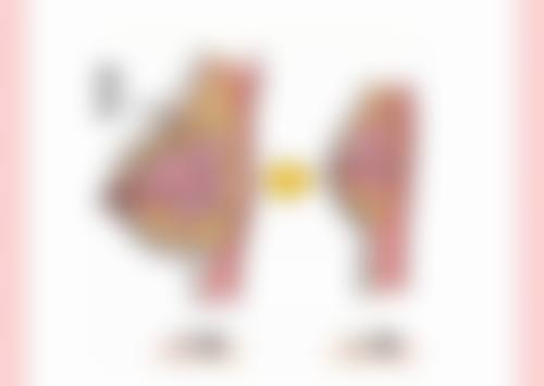 韩国粉毒瘦脸针安心吗