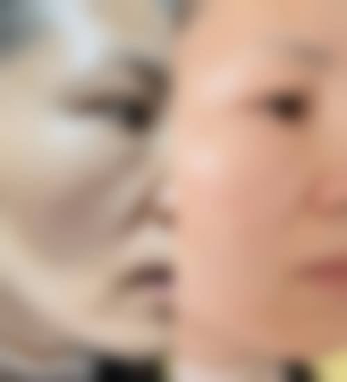 重庆市渝北区重庆欧亚毛发移植整形医院是一家私立医美医院,它具备合法的运营资质。在日常的医疗服务中,严格遵循相关的医疗规范和标准,为患者提供安心、有效的治疗。医院配备精良的毛发移植设备和技术,拥有经验多的专精团队,采用国内外精良的毛发移植技术,保护手术的安心性与成效,从这些方面都能体现出它的正规性。