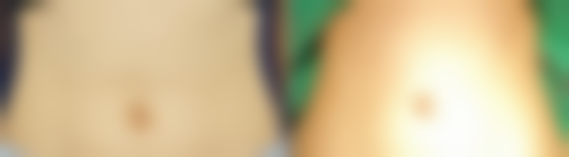 种植头发能维持多久寿命