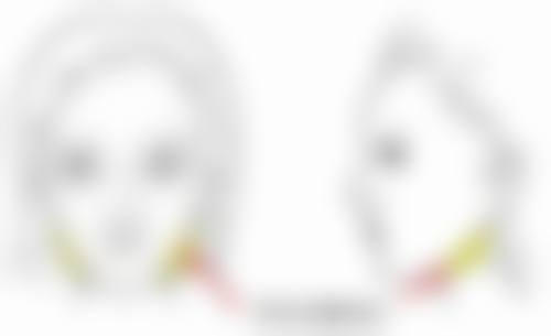 嘴角下垂整形过程