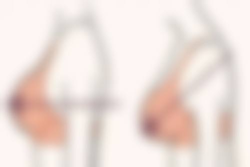 【杭州熹一乐医疗美容诊所怎么预约挂号?】