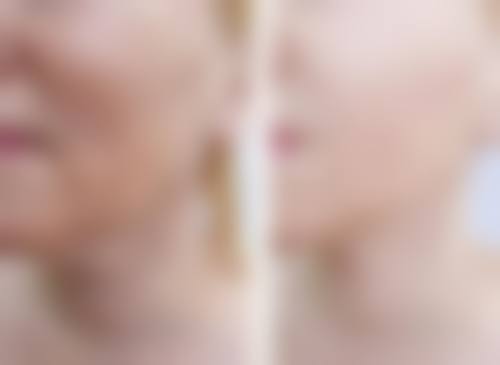 不慎服用禁忌药物怎么办