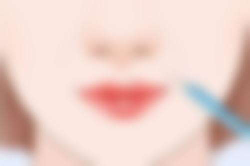 毛发种植的价格是多少高不高呢