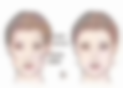 打瘦脸针有副作用