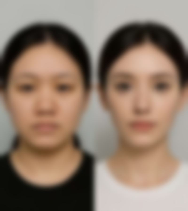 打美白针能维持多久