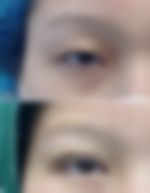 【武汉微幕医疗整形美容门诊部怎么预约挂号?】