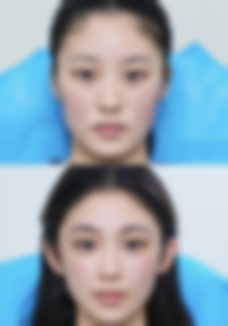 解决嘴角下垂的方法