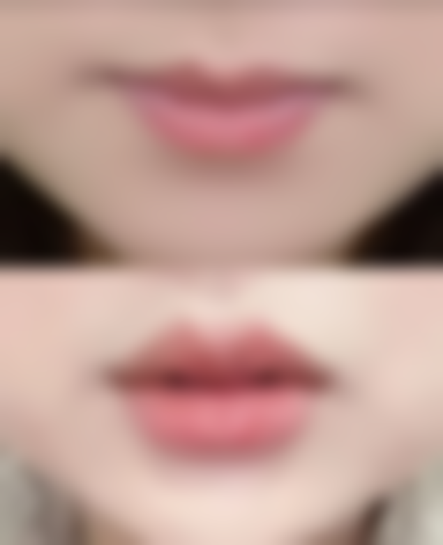 【 韩国世现Sehyeon整形医院是正规的吗?】