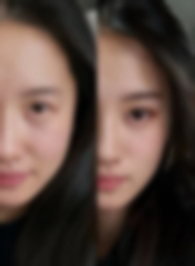 种植毛发有成效吗