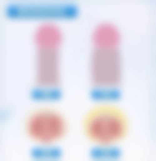 刚做完手术心率多少正常？