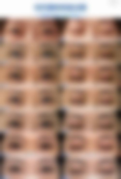 【韩国Mi&Mi秘安美皮肤科患者口碑评价:】