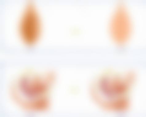 【王丽莎医生技术特点】