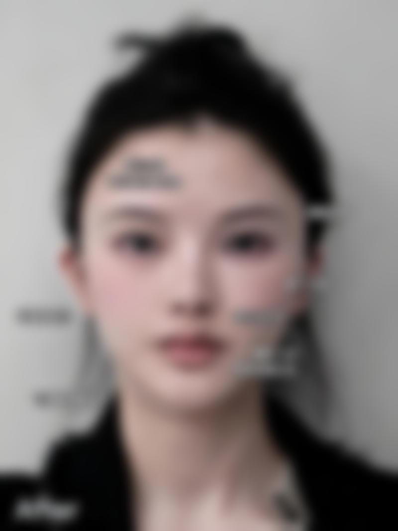 霍菲坐诊西安艺星医疗美容医院是否靠谱