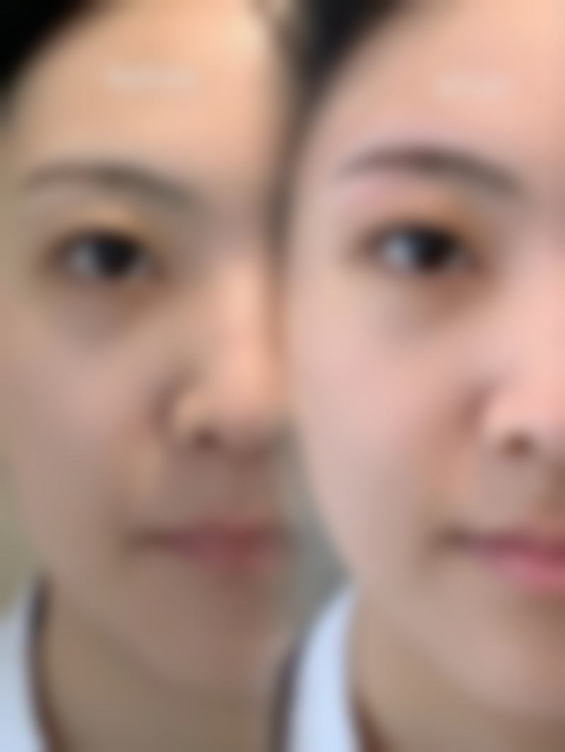 【马东医生技术特点:】