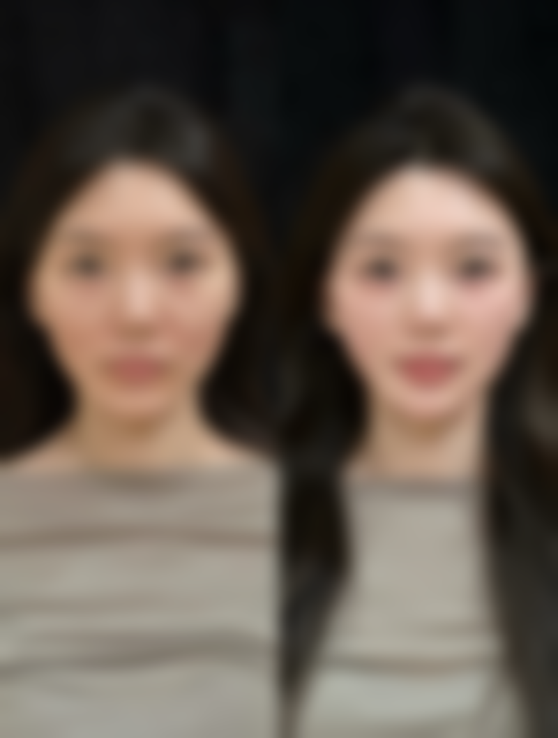 整容整嘴巴的是不是特别少