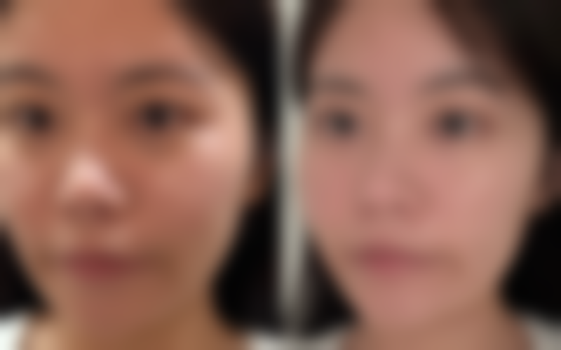 【密山宋开宇整形医院地址:】