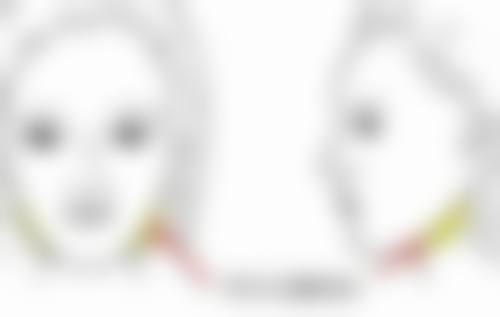 打瘦脸针会垮脸吗