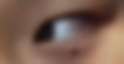 美白针打了多长时间可以变白？揭晓揭秘美白针快速显效时间，让您 30 天焕现肌肤透亮光彩！ 