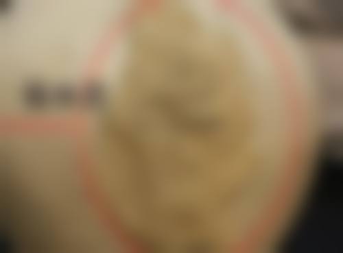 打咬肌瘦脸针有副作用吗?