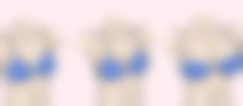 方脸瘦脸针前后对比