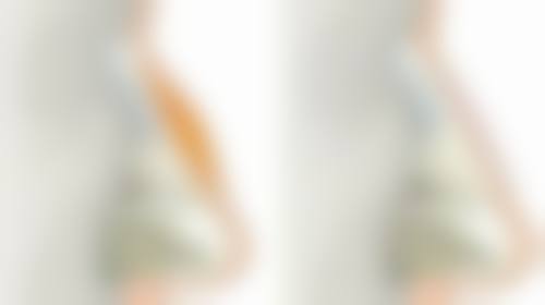 面部除皱的几种方法