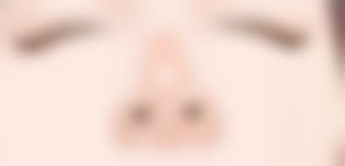 除皱针多久可以见到成效