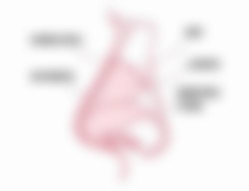 疤痕植发的过程与注意事项