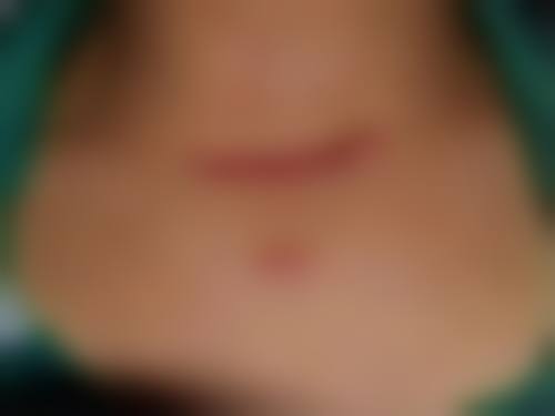 【淮安涟水县人民医院烧伤整形科怎么预约挂号?】