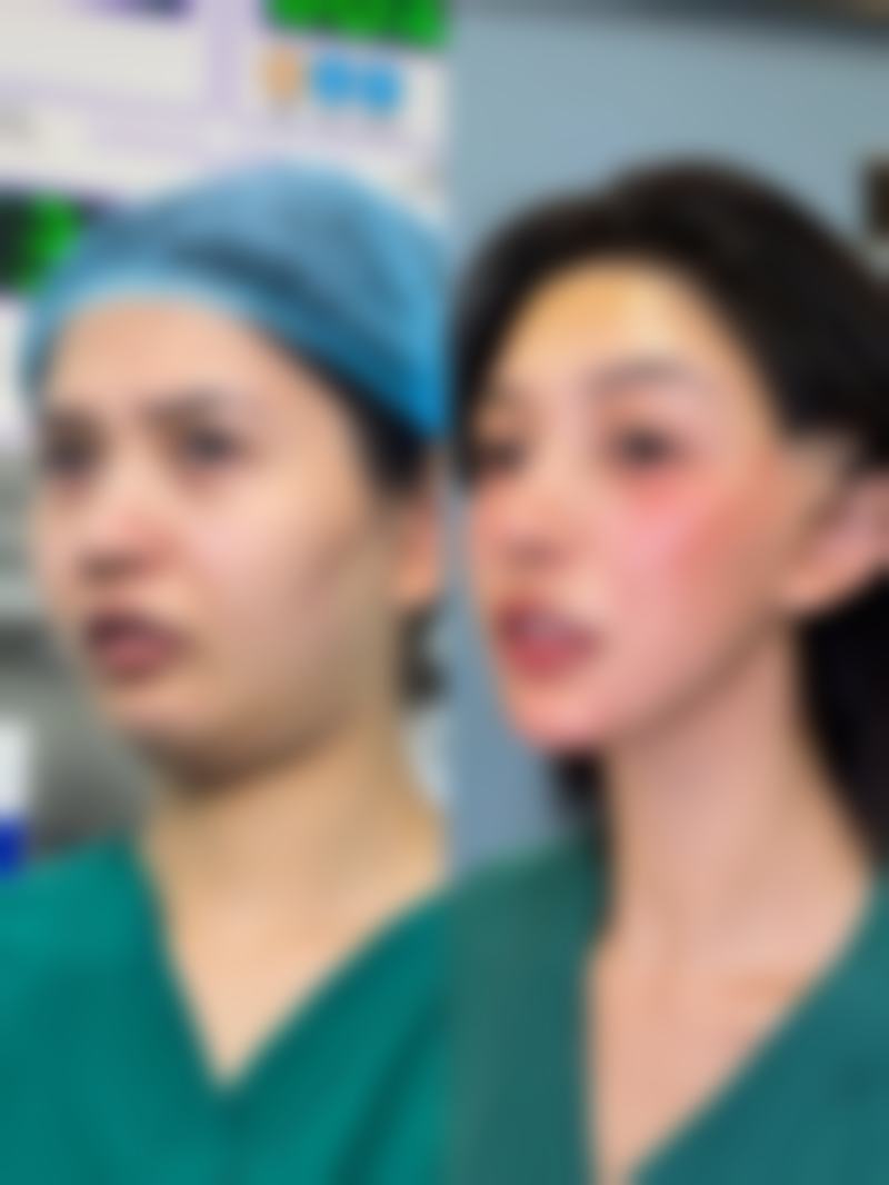 打瘦脸针需要注意什么