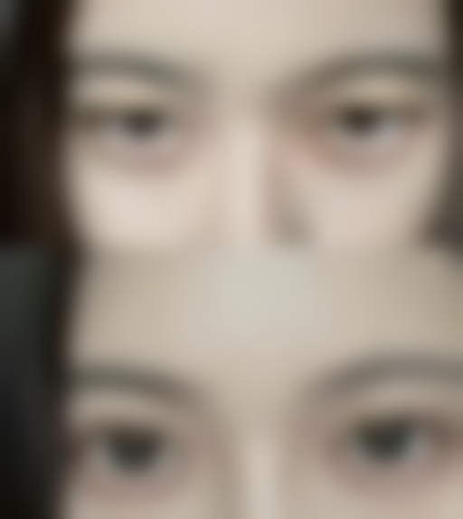 【张哲医生技术特点】