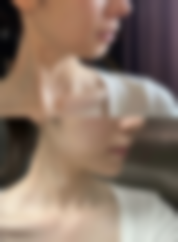 【宾冰医生擅长项目】