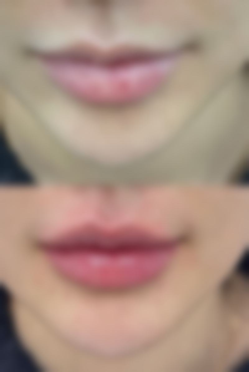 美白针价格及优势适用人群表格