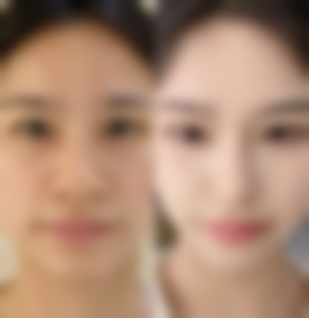 江岸区董雷和叶锋谁更适合面部整形